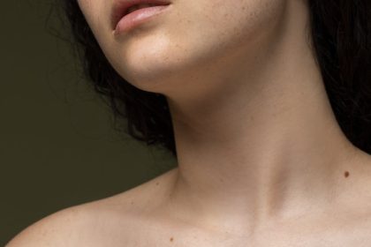 Is it a mole or a skin tag: Know the similarities and differences